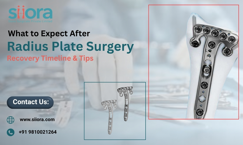 Radius Plate Surgery